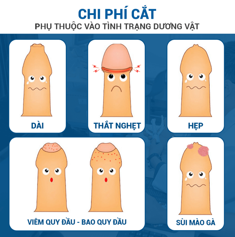 Chi phí cắt bao quy đầu phụ thuộc tình trạng bệnh